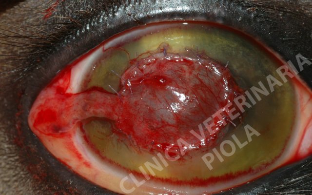 Cheratectomia profonda e lembo congiuntivale peduncolato